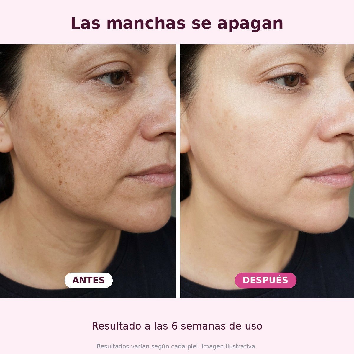 Sérum coreano 99% PDRN con péptidos y colágeno, 30 ml — Estela Couture